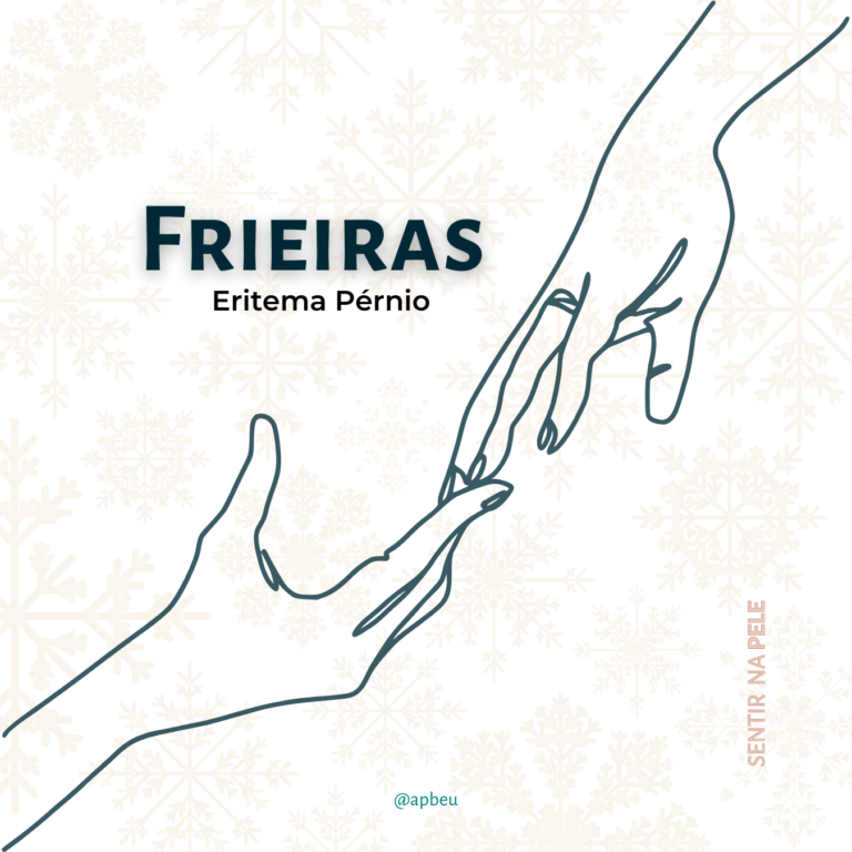 Eritema Pérnio: O vilão do Inverno? ❄️✋